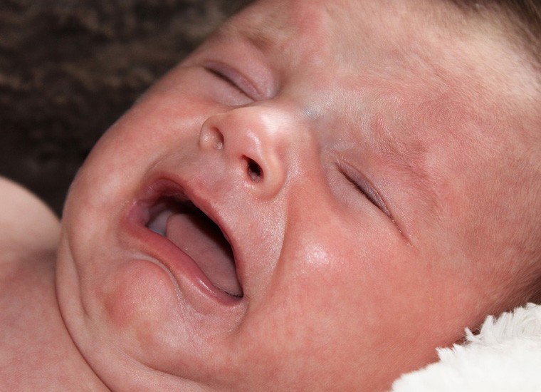 Mughetto nei neonati: cos’è e come curarlo