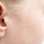 orecchio cerume