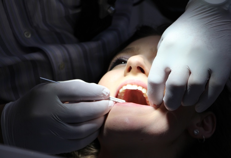 Il dente cariato: dall’interessamento del solo smalto all’ascesso