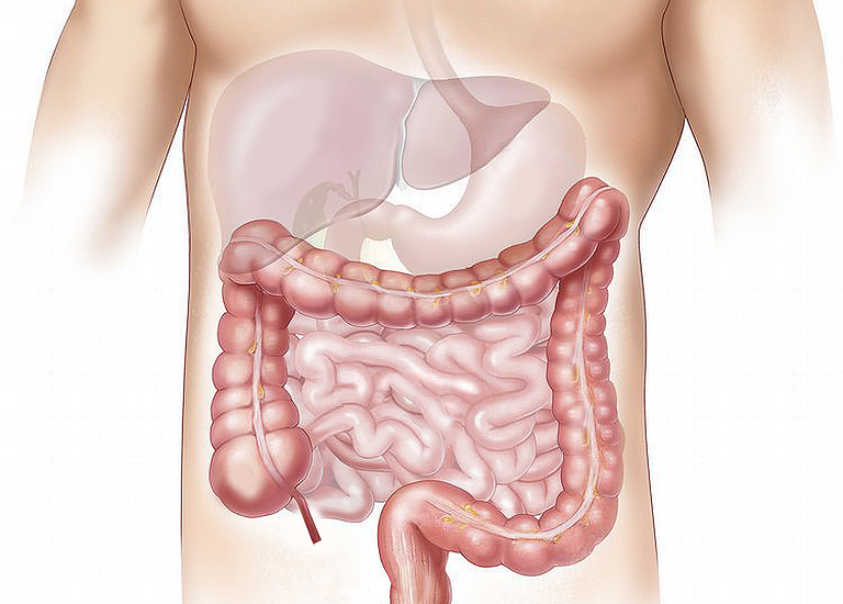 Scopriamo quali sono i sintomi della gastroenterite e le relative cure