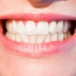 teeth-1652976_960_720
