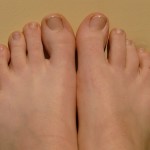 Malattie delle unghie delle mani e dei piedi, quali possono essere