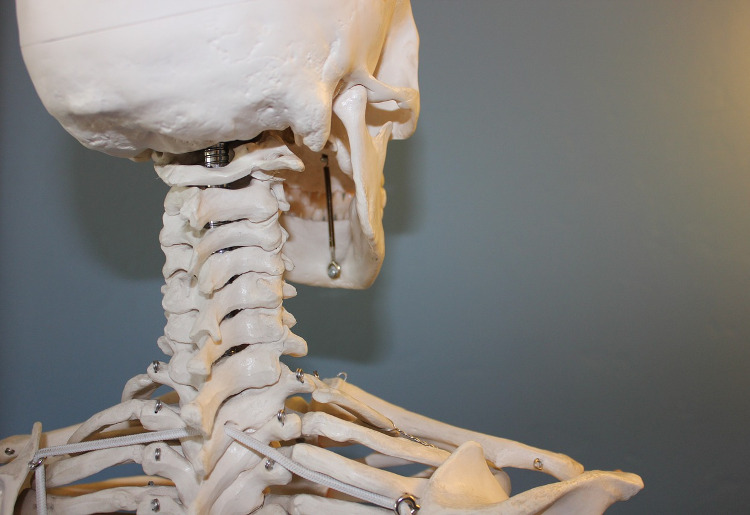 Osteoren: cos’è e come funziona?