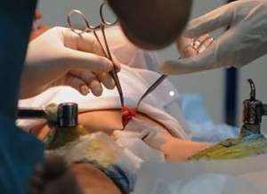 circoncisione prepuzio
